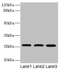 TMEM65 Antibody - Western blot All lanes: TMEM65 antibody at 6µg/ml Lane 1: Mouse liver tissue Lane 2: Mouse kidney tissue Lane 3: Mouse gonadal tissue Secondary Goat polyclonal to rabbit IgG at 1/10000 dilution Predicted band size: 25 kDa Observed band size: 25 kDa