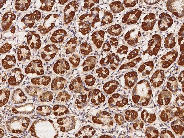 TMEM65 Antibody - Immunochemical staining of human TMEM65 in human stomach with rabbit polyclonal antibody at 1:100 dilution, formalin-fixed paraffin embedded sections.