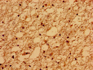 TMEM67 Antibody - Immunohistochemistry of paraffin-embedded human brain tissue using TMEM67 Antibody at dilution of 1:100