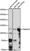 TMEM67 Antibody - Western blot analysis of extracts of various cell lines, using TMEM67 antibody at 1:1000 dilution. The secondary antibody used was an HRP Goat Anti-Rabbit IgG (H+L) at 1:10000 dilution. Lysates were loaded 25ug per lane and 3% nonfat dry milk in TBST was used for blocking. An ECL Kit was used for detection and the exposure time was 3min.