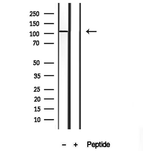 TMEM67 Antibody - Western blot analysis of extracts of human kidney using MKS3 antibody.