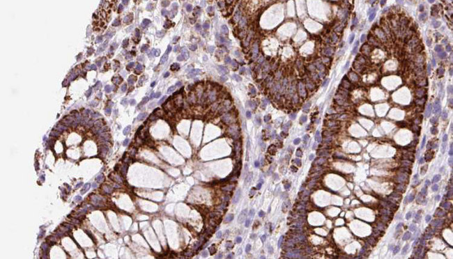 TMEM67 Antibody - 1:100 staining mouse colon tissue by IHC-P. The sample was formaldehyde fixed and a heat mediated antigen retrieval step in citrate buffer was performed. The sample was then blocked and incubated with the antibody for 1.5 hours at 22°C. An HRP conjugated goat anti-rabbit antibody was used as the secondary.