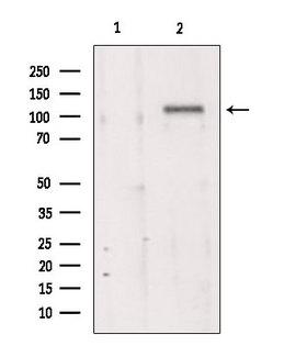 TMEM67 Antibody - Western blot analysis of extracts of 293 cells using MKS3 antibody. Lane 1 was treated with the blocking peptide.