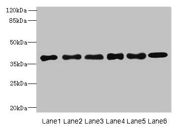 TMEM68 Antibody - Western blot All lanes: TMEM68 antibody at 4µg/ml Lane 1: Mouse thymus tissue Lane 2: K562 whole cell lysate Lane 3: U251 whole cell lysate Lane 4: HepG2 whole cell lysate Lane 5: MCF-7 whole cell lysate Lane 6: Jurkat whole cell lysate Secondary Goat polyclonal to rabbit IgG at 1/10000 dilution Predicted band size: 38, 30, 16 kDa Observed band size: 38 kDa
