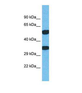 TMEM68 Antibody - Western blot of Human Jurkat. TMEM68 antibody dilution 1.0 ug/ml.  This image was taken for the unconjugated form of this product. Other forms have not been tested.