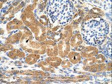TMEM69 Antibody - TMEM69 antibody TMEM69(transmembrane protein 69) Antibody was used in IHC to stain formalin-fixed, paraffin-embedded human kidney.  This image was taken for the unconjugated form of this product. Other forms have not been tested.
