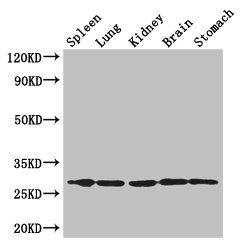 TMEM7 / RTP3 Antibody - Western Blot Positive WB detected in: Mouse spleen tissue, , Mouse lung tissue, Mouse kidney tissue, Mouse brain tissue, Mouse stomach tissue All lanes: RTP3 antibody at 3µg/ml Secondary Goat polyclonal to rabbit IgG at 1/50000 dilution Predicted band size: 28 kDa Observed band size: 28 kDa