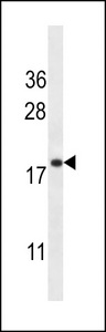 TMEM70 Antibody - TMM70 Antibody western blot of HL-60 cell line lysates (35 ug/lane). The TMM70 antibody detected the TMM70 protein (arrow).