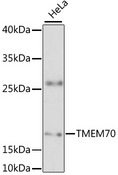 TMEM70 Antibody - Western blot analysis of extracts of HeLa cells, using TMEM70 antibody at 1:3000 dilution. The secondary antibody used was an HRP Goat Anti-Rabbit IgG (H+L) at 1:10000 dilution. Lysates were loaded 25ug per lane and 3% nonfat dry milk in TBST was used for blocking. An ECL Kit was used for detection and the exposure time was 90s.