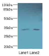 TMEM71 Antibody - Western blot. All lanes: TMEM71 antibody at 0.2 ug/ml. Lane 1: U937 whole cell lysate. Lane 2: U87 whole cell lysate. Secondary Goat polyclonal to Rabbit IgG at 1:10000 dilution. Predicted band size: 33 kDa. Observed band size: 33 kDa.