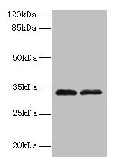 TMEM71 Antibody - Western blot All lanes: TMEM71 antibody at 0.2µg/ml Lane 1: U937 whole cell lysate Lane 2: U87 whole cell lysate Secondary Goat polyclonal to rabbit IgG at 1/10000 dilution Predicted band size: 33, 31, 27 kDa Observed band size: 33 kDa