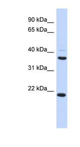 TMEM74 Antibody - TMEM74 antibody Western blot of Fetal Heart lysate. This image was taken for the unconjugated form of this product. Other forms have not been tested.