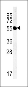 TMEM79 Antibody - Western blot of lysate from PC-3 cell line, using TMM79 Antibody. Antibody was diluted at 1:1000 at each lane. A goat anti-rabbit IgG H&L (HRP) at 1:5000 dilution was used as the secondary antibody. Lysate at 35ug per lane.