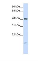 TMEM79 Antibody - Placenta lysate. Antibody concentration: 1.0 ug/ml. Gel concentration: 12%.  This image was taken for the unconjugated form of this product. Other forms have not been tested.