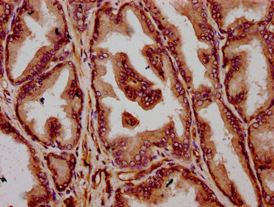 TMEM79 Antibody - Immunohistochemistry Dilution at 1:300 and staining in paraffin-embedded human prostate tissue performed on a Leica BondTM system. After dewaxing and hydration, antigen retrieval was mediated by high pressure in a citrate buffer (pH 6.0). Section was blocked with 10% normal Goat serum 30min at RT. Then primary antibody (1% BSA) was incubated at 4°C overnight. The primary is detected by a biotinylated Secondary antibody and visualized using an HRP conjugated SP system.