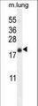 TMEM80 Antibody - TMEM80 Antibody western blot of mouse lung tissue lysates (35 ug/lane). The TMEM80 antibody detected the TMEM80 protein (arrow).
