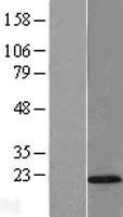 TMEM80 Protein - Western validation with an anti-DDK antibody * L: Control HEK293 lysate R: Over-expression lysate