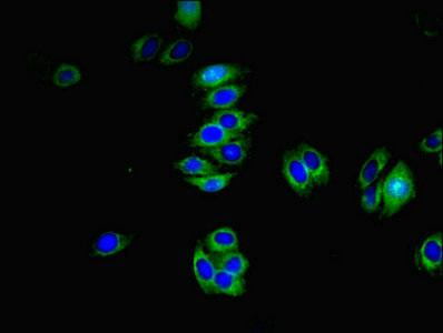TMEM82 Antibody - Immunofluorescent analysis of HepG2 cells using TMEM82 Antibody at dilution of 1:100 and Alexa Fluor 488-congugated AffiniPure Goat Anti-Rabbit IgG(H+L)
