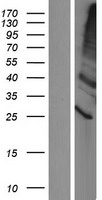 TMEM86A Protein - Western validation with an anti-DDK antibody * L: Control HEK293 lysate R: Over-expression lysate