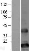 TMEM86B Protein - Western validation with an anti-DDK antibody * L: Control HEK293 lysate R: Over-expression lysate