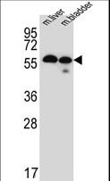 TMEM87B Antibody - Western blot of TMEM87B Antibody in mouse liver,bladder tissue lysates (35 ug/lane). TMEM87B (arrow) was detected using the purified antibody.