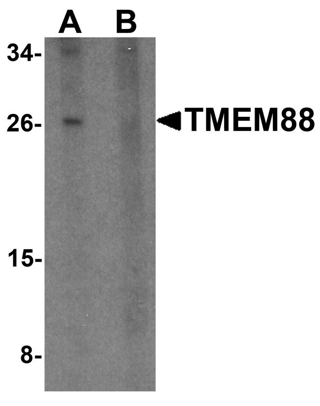 TMEM88 Antibody - Western blot analysis of TMEM88 in human brain tissue lysate with TMEM88 antibody at 1 ug/ml in (A) the absence and (B) the presence of blocking peptide.