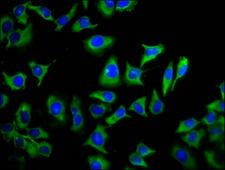 TMEM88 Antibody - Immunofluorescence staining of A549 cells diluted at 1:133, counter-stained with DAPI. The cells were fixed in 4% formaldehyde, permeabilized using 0.2% Triton X-100 and blocked in 10% normal Goat Serum. The cells were then incubated with the antibody overnight at 4°C.The Secondary antibody was Alexa Fluor 488-congugated AffiniPure Goat Anti-Rabbit IgG (H+L).