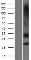 TMEM88 Protein - Western validation with an anti-DDK antibody * L: Control HEK293 lysate R: Over-expression lysate