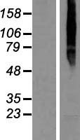 TMEM8A Protein - Western validation with an anti-DDK antibody * L: Control HEK293 lysate R: Over-expression lysate