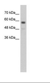 TMEM8B / NGX6 Antibody - Jurkat Cell Lysate.  This image was taken for the unconjugated form of this product. Other forms have not been tested.