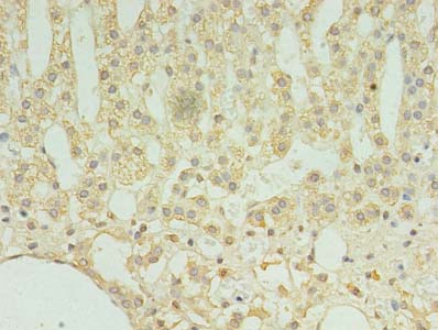 TMEM9 Antibody - Immunohistochemistry of paraffin-embedded human adrenal gland tissue using antibody at dilution of 1:100.