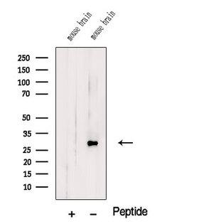 TMEM9 Antibody - Western blot analysis of extracts of mouse brain tissue using TMEM9 antibody. The lane on the left was treated with blocking peptide.