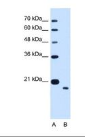 TMEM91 Antibody - Lane A: Marker. Lane B: HepG2 cell lysate. Antibody concentration: 1.25 ug/ml. Gel concentration: 12%.  This image was taken for the unconjugated form of this product. Other forms have not been tested.