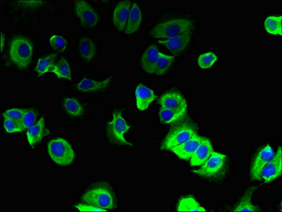 TMEM91 Antibody - Immunofluorescent analysis of MCF-7 cells using TMEM91 Antibody at dilution of 1:100 and Alexa Fluor 488-congugated AffiniPure Goat Anti-Rabbit IgG(H+L)