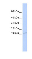 TMEM93 Antibody - TMEM93 antibody Western blot of Jurkat lysate. This image was taken for the unconjugated form of this product. Other forms have not been tested.