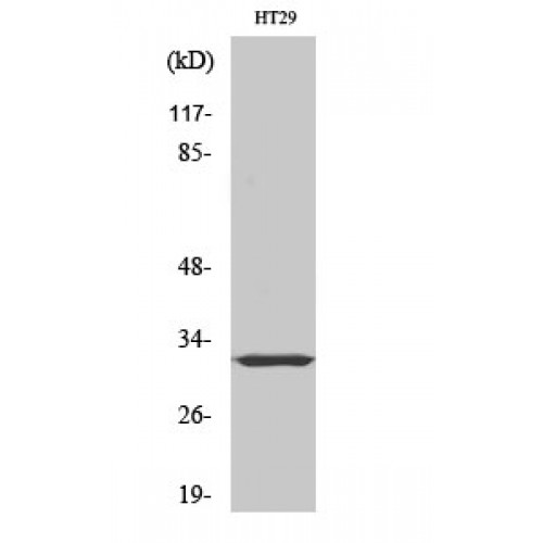 TMEPAI / PMEPA1 Antibody - Western blot of PMEPA1 antibody