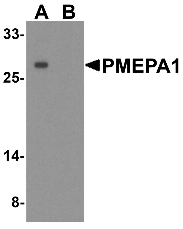 TMEPAI / PMEPA1 Antibody - Western blot analysis of PMEPA1 inA549 cell lysate with PMEPA1 antibody at 1 ug/ml in (A) the absence and (B) the presence of blocking peptide.