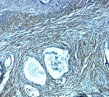 TMEPAI / PMEPA1 Antibody - Immunohistochemistry of PMEPA1 in human prostate tissue with PMEPA1 antibody at 2.5 ug/ml.