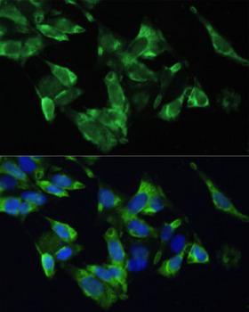 TMEPAI / PMEPA1 Antibody - Immunofluorescence analysis of U2OS cells using PMEPA1 antibody at dilution of 1:100. Blue: DAPI for nuclear staining.