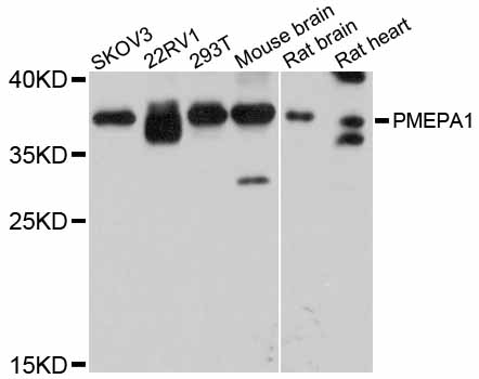 TMEPAI / PMEPA1 Antibody - Western blot analysis of extracts of various cell lines, using PMEPA1 antibody at 1:3000 dilution. The secondary antibody used was an HRP Goat Anti-Rabbit IgG (H+L) at 1:10000 dilution. Lysates were loaded 25ug per lane and 3% nonfat dry milk in TBST was used for blocking. An ECL Kit was used for detection and the exposure time was 30s.