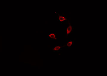 TMEPAI / PMEPA1 Antibody - Staining HT29 cells by IF/ICC. The samples were fixed with PFA and permeabilized in 0.1% Triton X-100, then blocked in 10% serum for 45 min at 25°C. The primary antibody was diluted at 1:200 and incubated with the sample for 1 hour at 37°C. An Alexa Fluor 594 conjugated goat anti-rabbit IgG (H+L) antibody, diluted at 1/600, was used as secondary antibody.