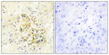 TMEPAI / PMEPA1 Antibody - Peptide - + Immunohistochemistry analysis of paraffin-embedded human prostate tissue using TMEPA antibody.