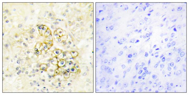 TMEPAI / PMEPA1 Antibody - Peptide - + Immunohistochemistry analysis of paraffin-embedded human prostate tissue using TMEPA antibody.