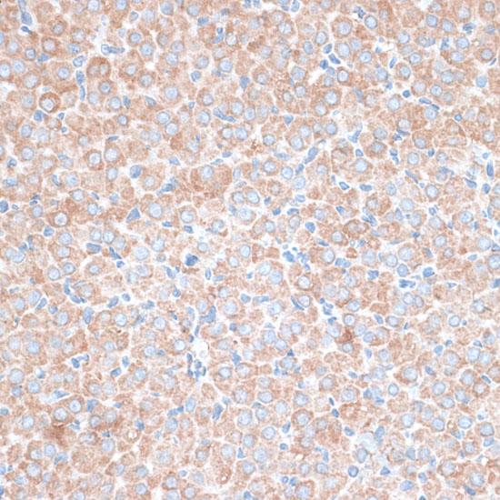TMEPAI / PMEPA1 Antibody - Immunohistochemistry of paraffin-embedded Rat ovary using PMEPA1 Polyclonal Antibody at dilution of 1:100 (40x lens).
