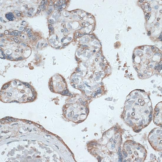 TMEPAI / PMEPA1 Antibody - Immunohistochemistry of paraffin-embedded Human placenta using PMEPA1 Polyclonal Antibody at dilution of 1:100 (40x lens).
