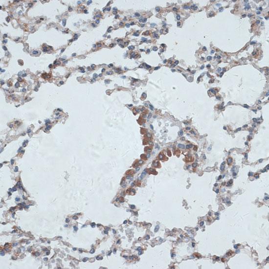 TMEPAI / PMEPA1 Antibody - Immunohistochemistry of paraffin-embedded Mouse lung using PMEPA1 Polyclonal Antibody at dilution of 1:100 (40x lens).