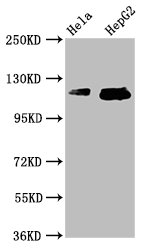 TMF1 / TMF-1 Antibody - Western Blot Positive WB detected in: Hela whole cell lysate, HepG2 whole cell lysate All Lanes: TMF1 antibody at 3.7µg/ml Secondary Goat polyclonal to rabbit IgG at 1/50000 dilution Predicted band size: 123, 124 KDa Observed band size: 123, 124 KDa