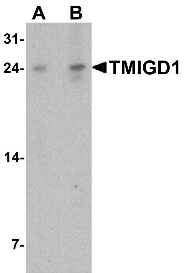 TMIGD1 Antibody - Western blot analysis of TMIGD1 in rat liver tissue lysate with TMIGD1 antibody at (A) 1 and (B) 2 ug/ml.