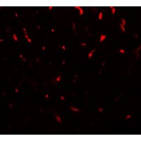 TMIGD1 Antibody - Immunofluorescence of TMIGD1 in mouse liver tissue with TMIGD1 antibody at 20 µg/mL.