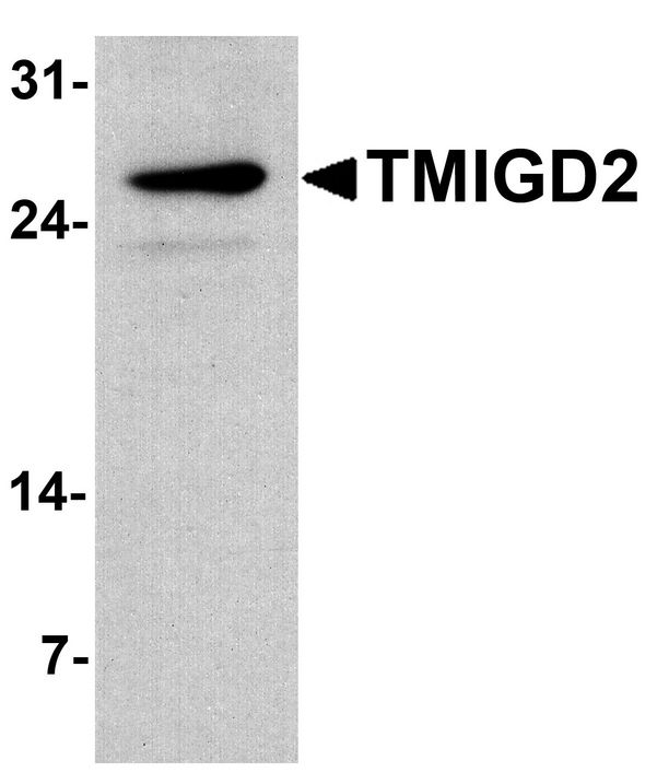 TMIGD2 Antibody - Western blot analysis of TMIGD2 in mouse small intestine tissue lysate with TMIGD2 antibody at 1 ug/ml.